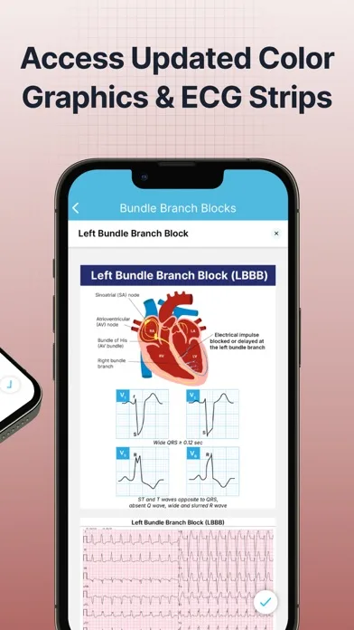 ECG EKG Interpretation Mastery screenshot 2