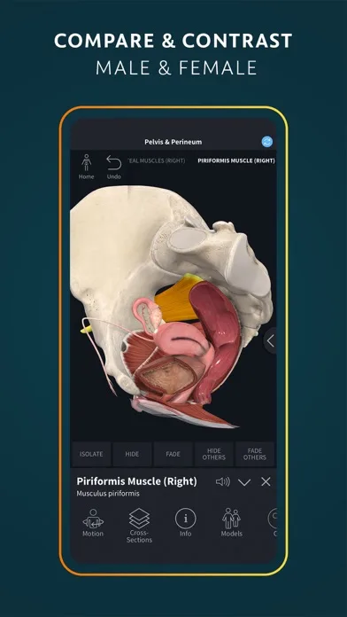 Complete Anatomy for iPhone screenshot 4