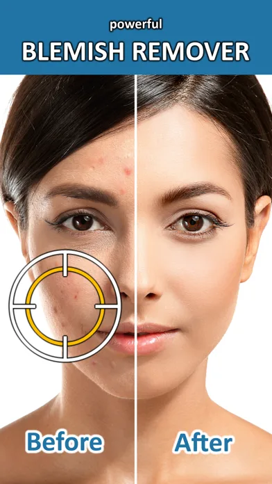 Blemish Remover Photo Tool screenshot 1