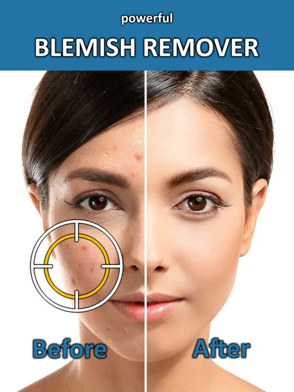 Blemish Remover Photo Tool screenshot 5