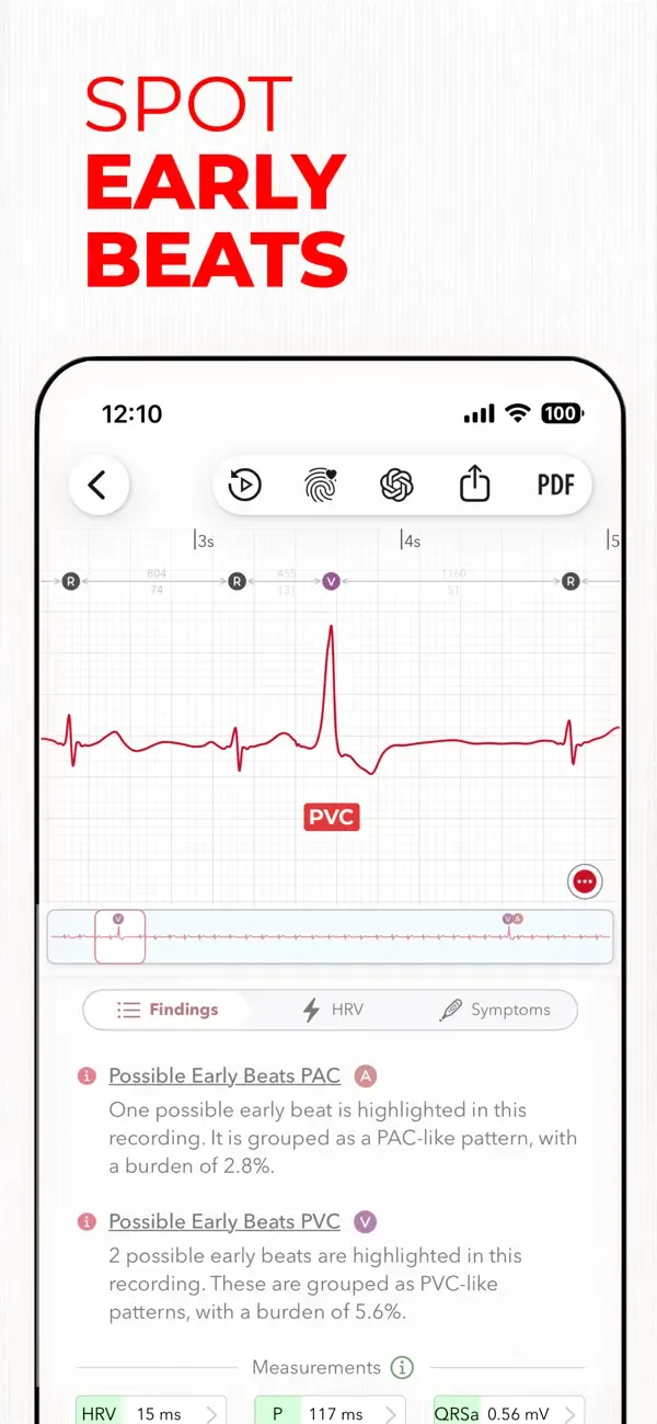 ECG+ | Your Watch ECG Reader screenshot 1