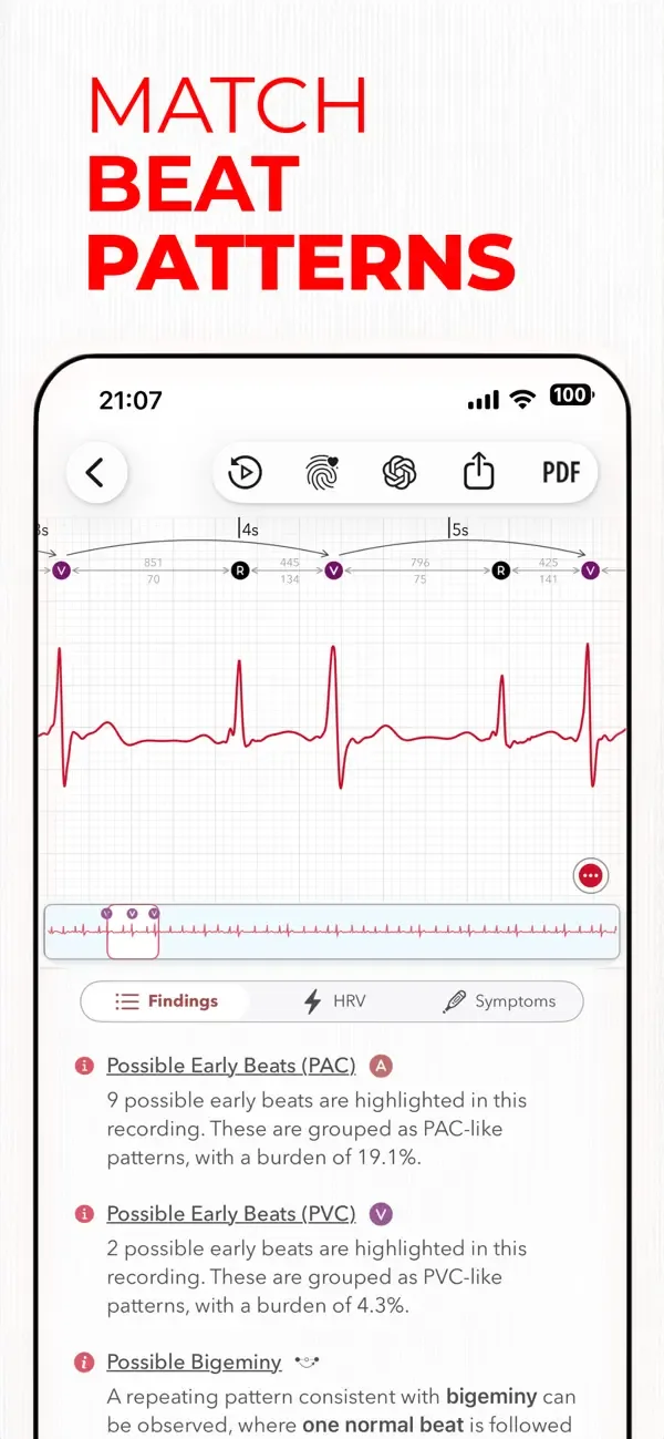 ECG+ | Your Watch ECG Reader screenshot 3