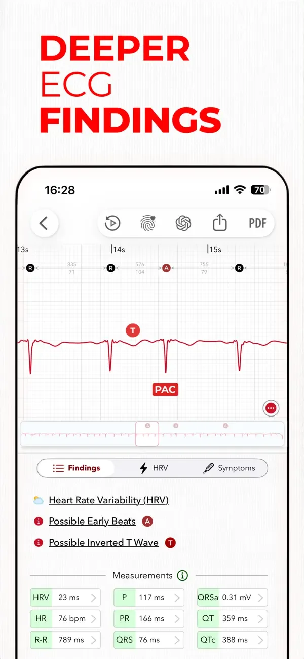 ECG+ | Your Watch ECG Reader screenshot 5