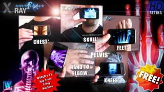 Amazing X-Ray FX ² LITE screenshot 1