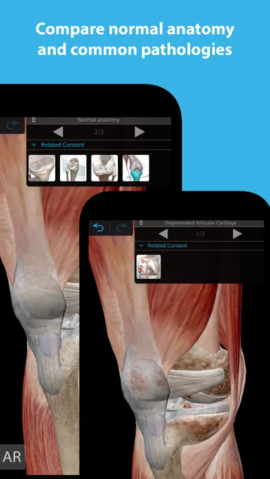 Muscles & Kinesiology screenshot 2