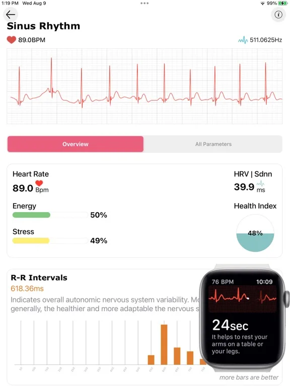 ECG heart analyze - watch screenshot 5