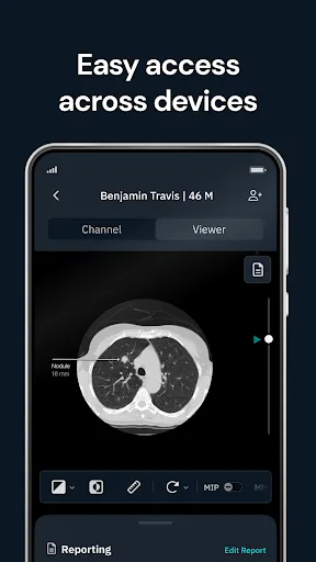 Qure.ai screenshot 1