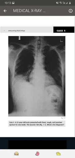X RAY Interpretation - cases screenshot 3