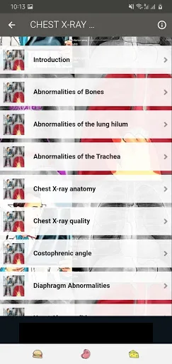 X RAY Interpretation - cases screenshot 4