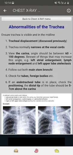 X RAY Interpretation - cases screenshot 5