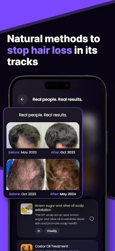 HairSnap Hair & Style Analysis screenshot 5