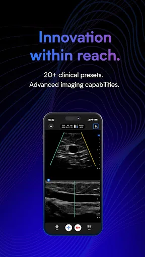 Butterfly iQ — Ultrasound screenshot 2