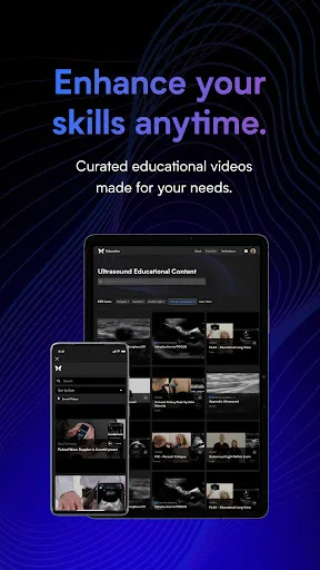 Butterfly iQ — Ultrasound screenshot 4