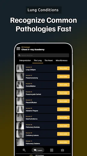 Chest Xray Academy | CXR Cases screenshot 2