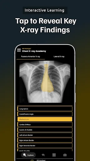 Chest Xray Academy | CXR Cases screenshot 3