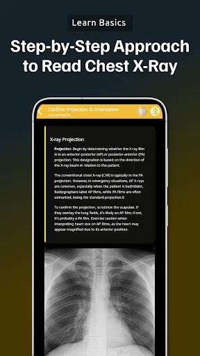 Chest Xray Academy | CXR Cases screenshot 4