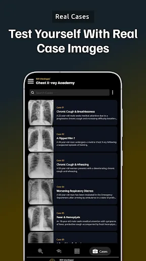Chest Xray Academy | CXR Cases screenshot 5