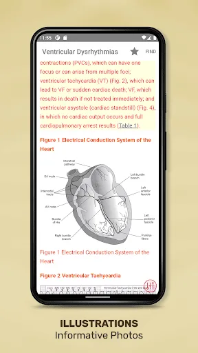Diseases & Disorders: Nursing screenshot 3