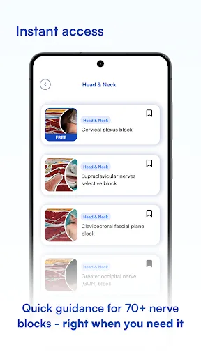 NYSORA Nerve Blocks screenshot 4