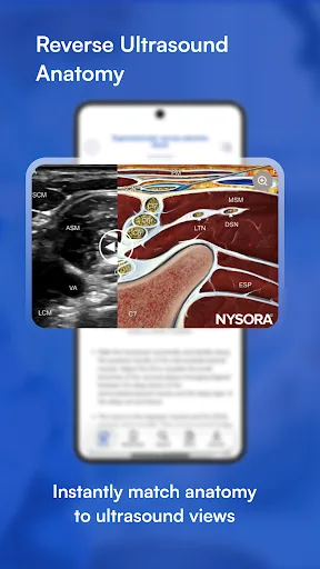 NYSORA Nerve Blocks screenshot 5