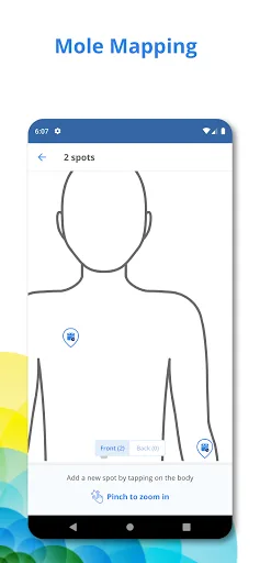 SkinVision - Find Skin Cancer screenshot 4