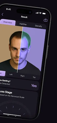 Hair Loss AI therapy & scanner screenshot 2