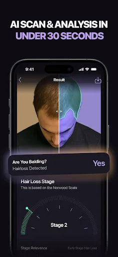 Hair Loss AI therapy & scanner screenshot 3