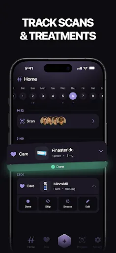 Hair Loss AI therapy & scanner screenshot 5
