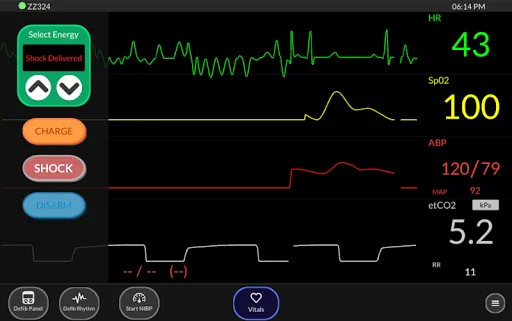 Simpl Patient Monitor screenshot 4