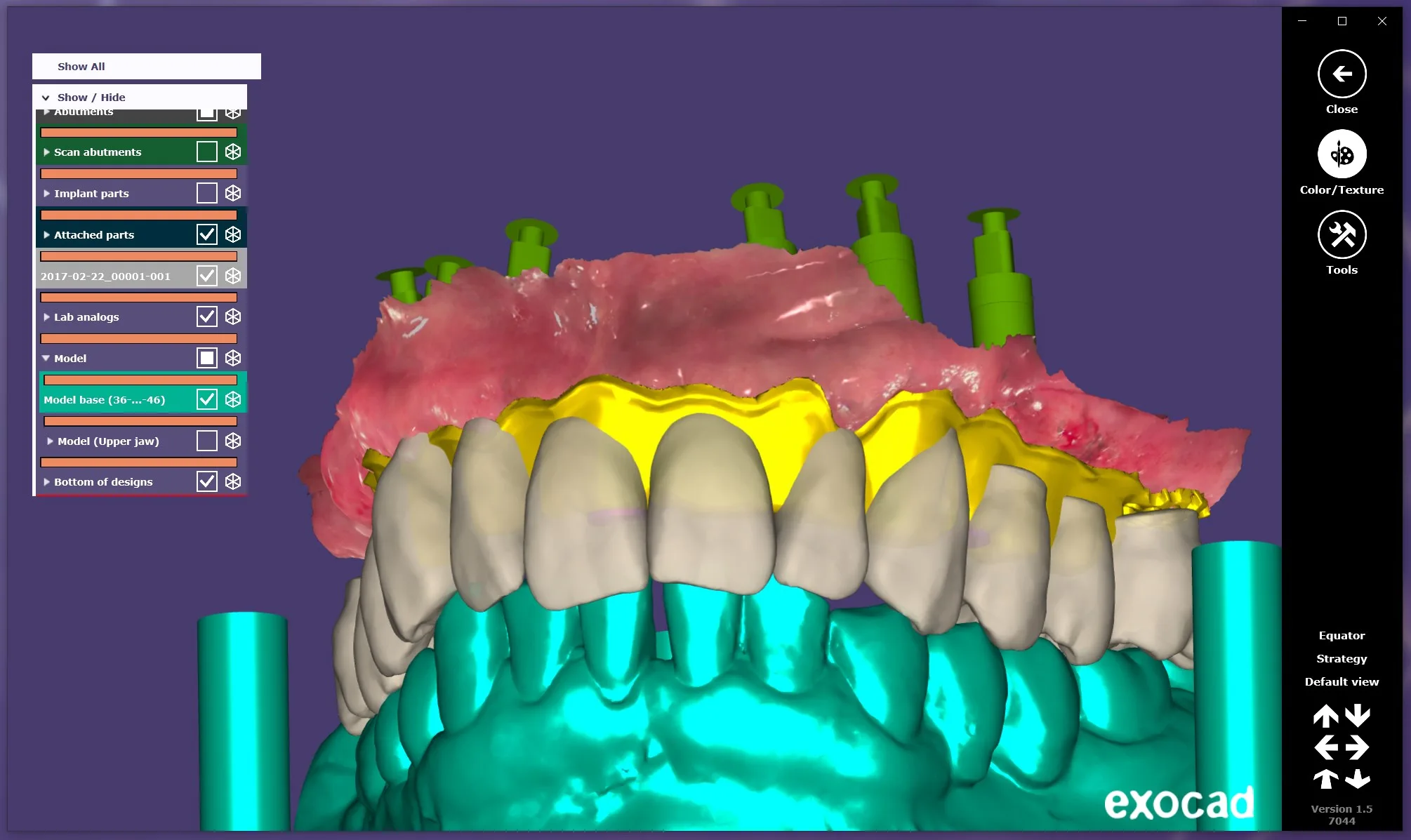 exocad view screenshot 5