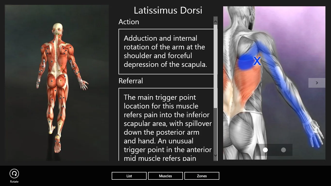 Muscle Trigger Points screenshot 2