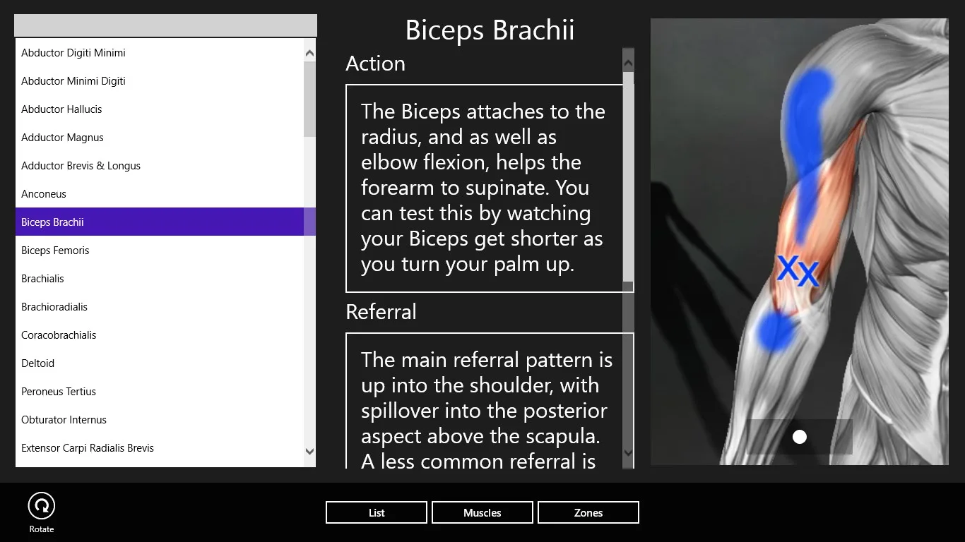 Muscle Trigger Points screenshot 3