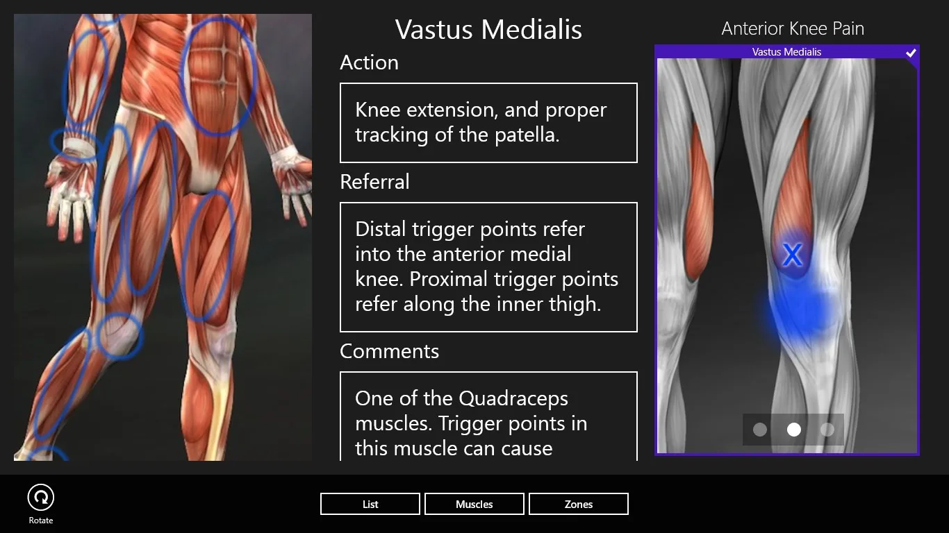 Muscle Trigger Points screenshot 4