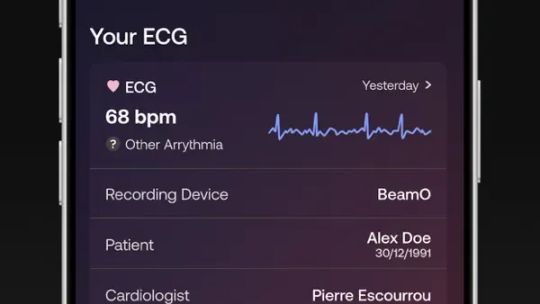 Withings Health Mate screenshot 5