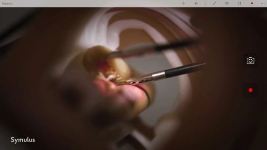 Symulus Vision screenshot 2