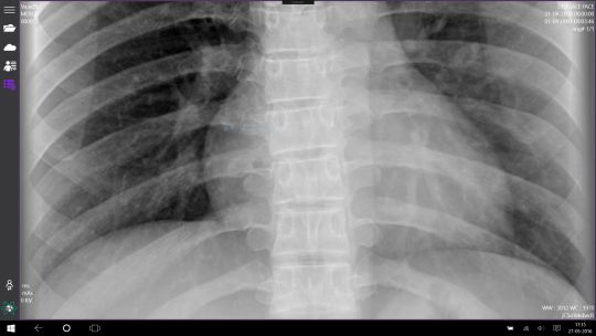 StellarPACS DICOM Viewer screenshot 5