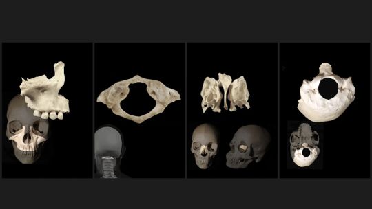 Anatomy Quiz Pro screenshot 3