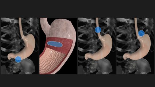 Anatomy Quiz Pro screenshot 5